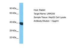 LRRC69 Rabbit anti-Human, Polyclonal, Novus Biologicals 0.1 mL | Buy Online | Novus Biologicals | Fisher Scientific